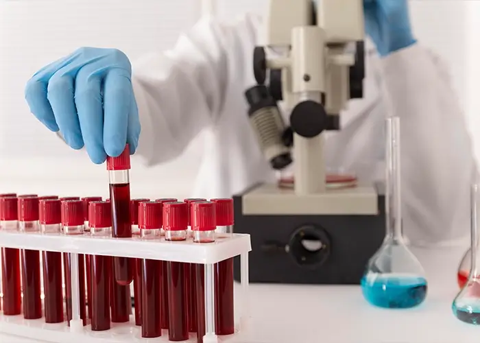 hematologista imagem